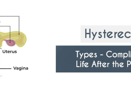 Hysterectomy: What it is and what to look out for